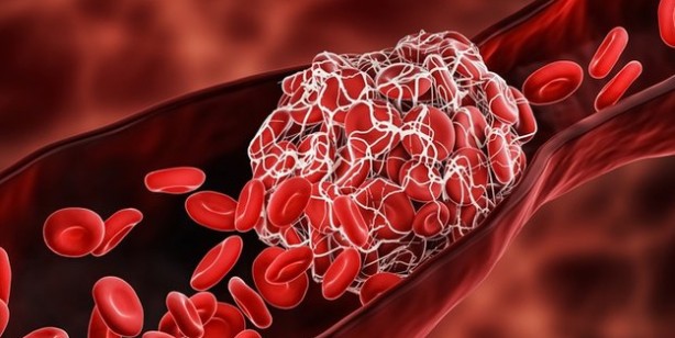 Foto - Altın sütü tarifi: Damarlardaki pıhtılaşmayı önlüyor, karaciğer ve beyni koruyor 