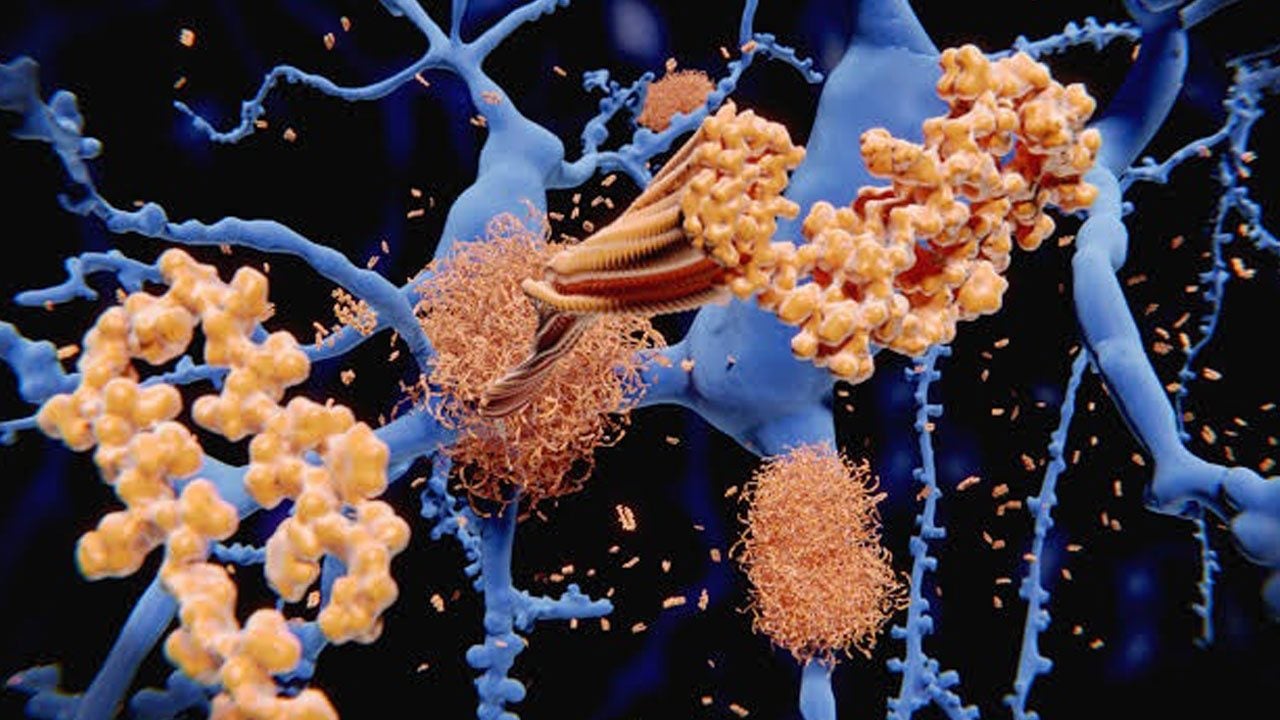 Foto - Alzheimer araştırmalarında heyecanlandıran keşif ! Beyinde daha önce bilinmeyen "temizlik ağı" bulundu
