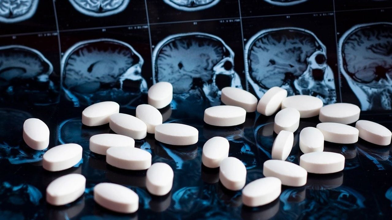 Foto - Alzheimer araştırmalarında heyecanlandıran keşif ! Beyinde daha önce bilinmeyen "temizlik ağı" bulundu