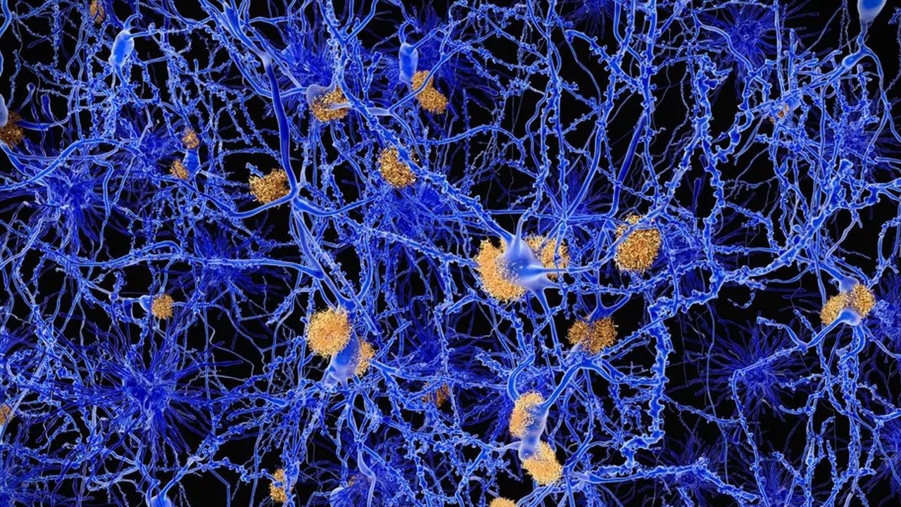 Foto - Alzheimer araştırmalarında heyecanlandıran keşif ! Beyinde daha önce bilinmeyen "temizlik ağı" bulundu
