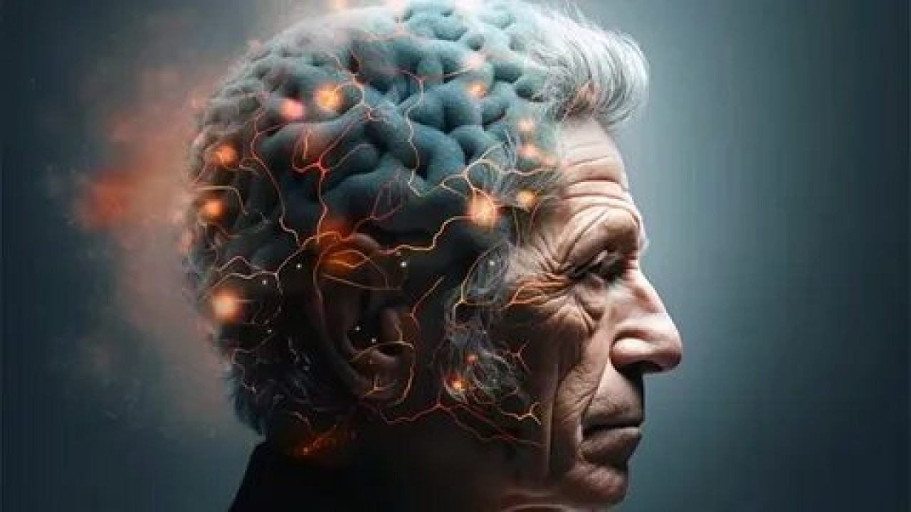 Alzheimer sinsice ilerliyor! Uzmanlardan erken teşhis uyarısı
