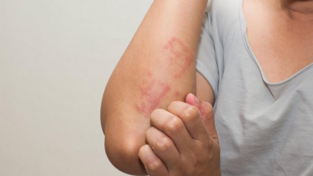 Foto - Aman dikkat! Çorabınız bileğinizde iz bırakıyorsa...