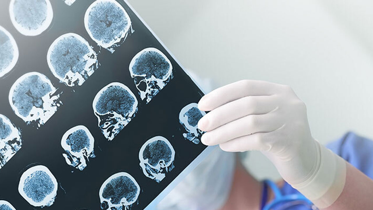 Foto - Aman dikkat herkesin başına gelebilir! Gece başlayan uyuşukluk ölümcül hastalığın habercisi olabilir