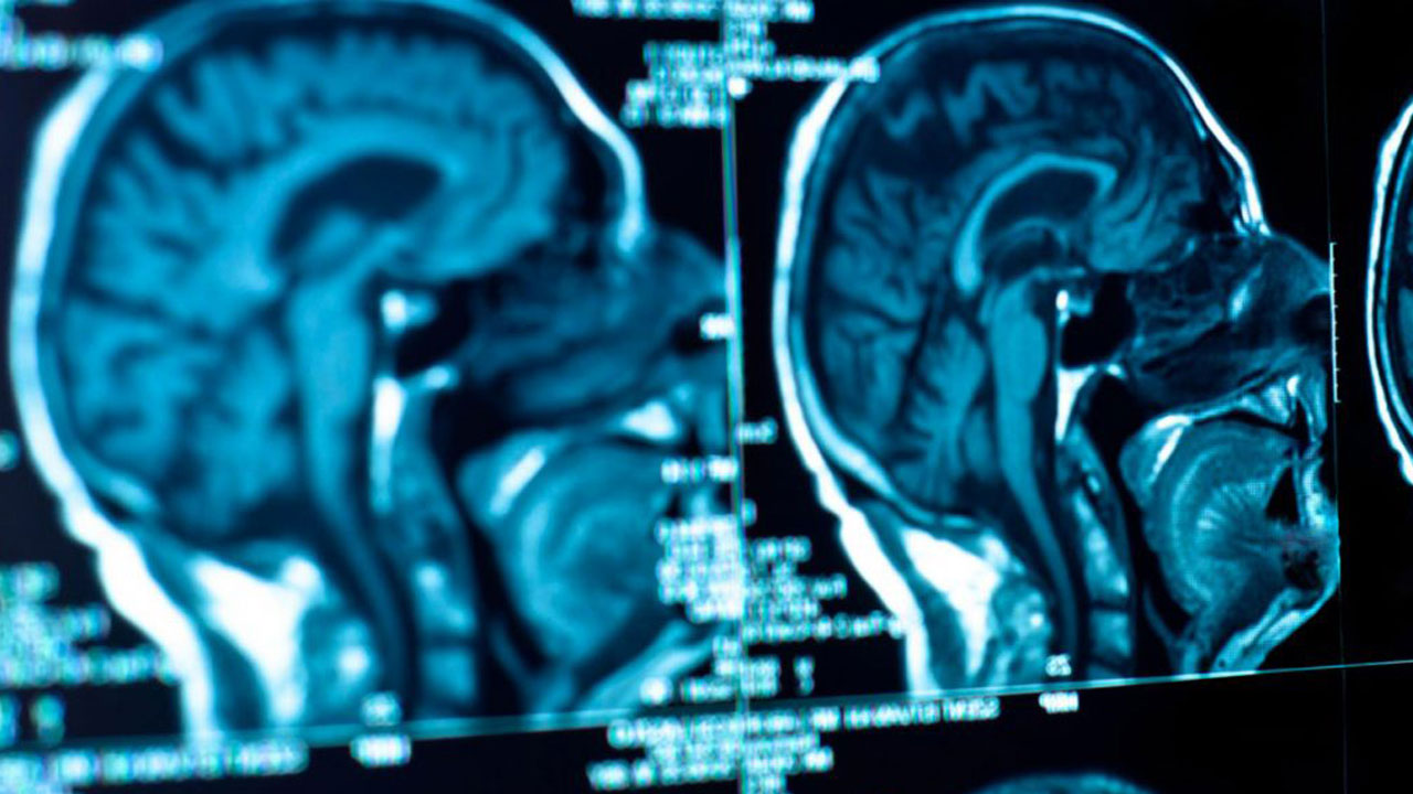 Aman dikkat herkesin başına gelebilir! Gece başlayan uyuşukluk ölümcül hastalığın habercisi olabilir