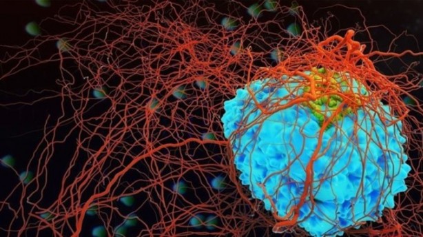 Foto - Beyin tümörünün habercisi olan bu belirtilere aman dikkat!