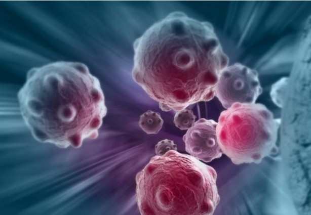 Foto - Beyin tümörünün habercisi olan bu belirtilere aman dikkat!