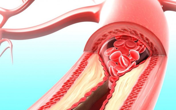 Foto - Aman dikkat! Rutin kontroller çok önemli! Kalp hastalıklarından sonra ikinci sırada! Ölüm riski oldukça fazla!