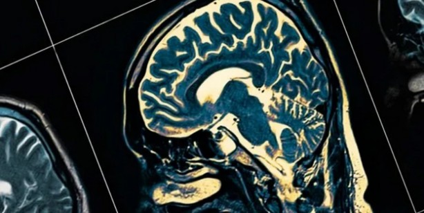 Foto - Aman dikkat: Uzun süreli derin yağda kızartılmış yağ... Beyni çürütüyor! 