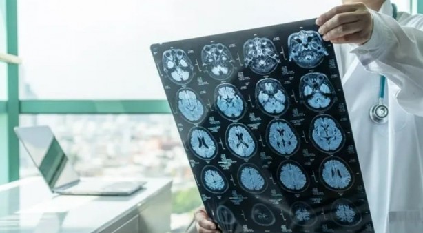 Aman dikkat: Uzun süreli derin yağda kızartılmış yağ... Beyni çürütüyor! 