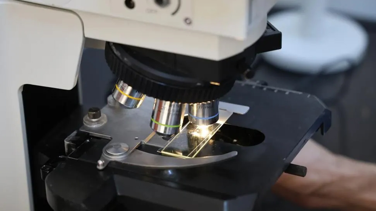 Foto - Aman dikkat! Vaka sayısı artıyor! Bu hastalık temas yoluyla bulaşıyor