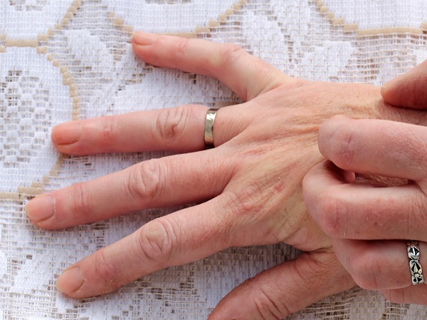 Foto - Aman eksik etmeyin! Tam bir B12 deposu