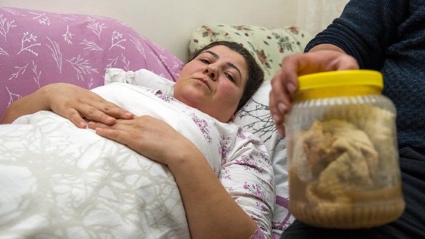 Foto - Ameliyatlarda hastaların içinde unutulan enteresan şeyler!