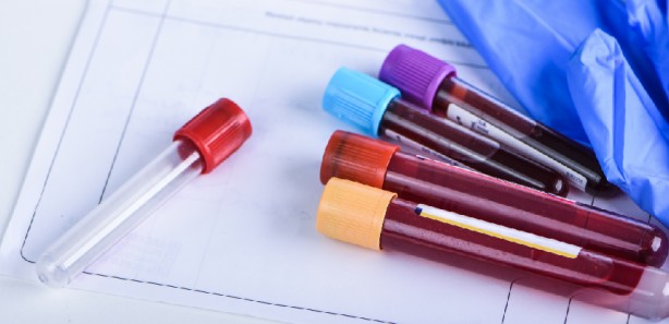 Foto - Aneminin 9 belirtisi