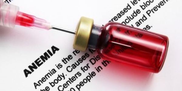 Foto - Aneminin 9 belirtisi
