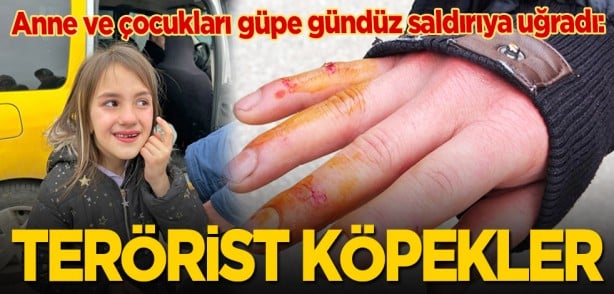 Anne ve çocukları saldırıya uğradı: Terörist köpekler
