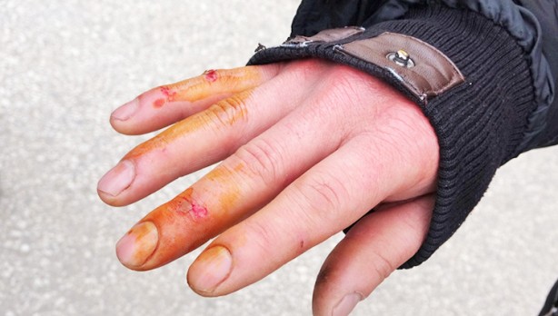 Foto - Anne ve çocukları saldırıya uğradı: Terörist köpekler