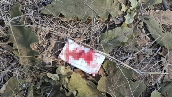 Foto - Antalya'da bir garip trafik kazası