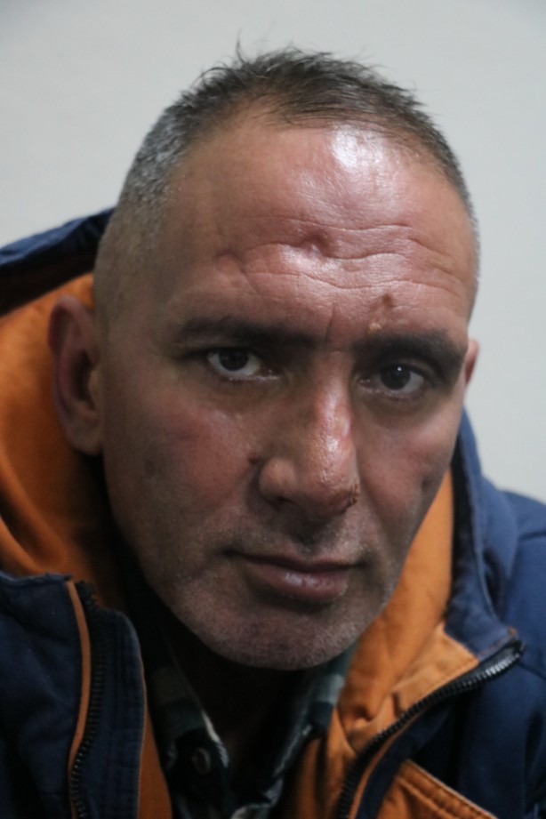 Foto - Antalya'ya çalışmaya giden işçinin hayatı sinek ısırması ile kabusa döndü!