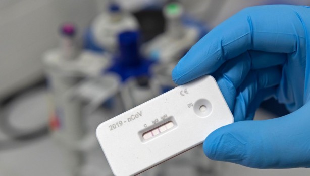 Foto - Antikor testi hangi illerde yapılacak? Antikor testlerinin yapılacağı iller listesi