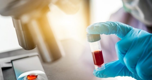 Foto - Antikor testi hangi illerde yapılacak? Antikor testlerinin yapılacağı iller listesi