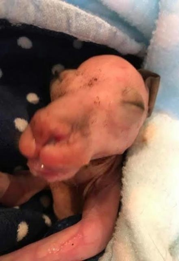 Foto - Arabanın çarpıp kaçtığı annenin karnından çıktı