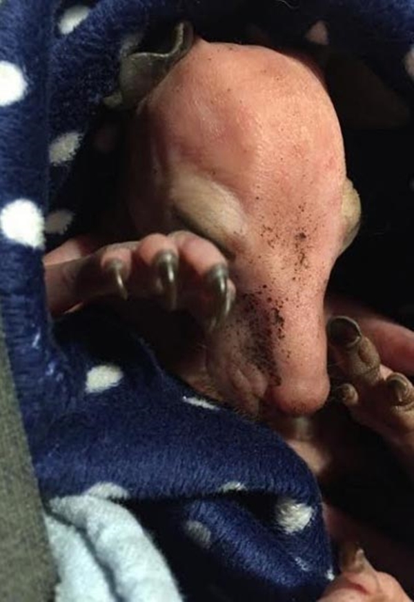 Foto - Arabanın çarpıp kaçtığı annenin karnından çıktı