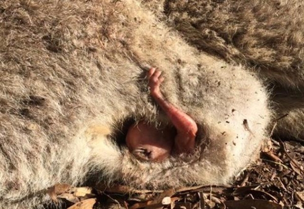 Arabanın çarpıp kaçtığı annenin karnından çıktı