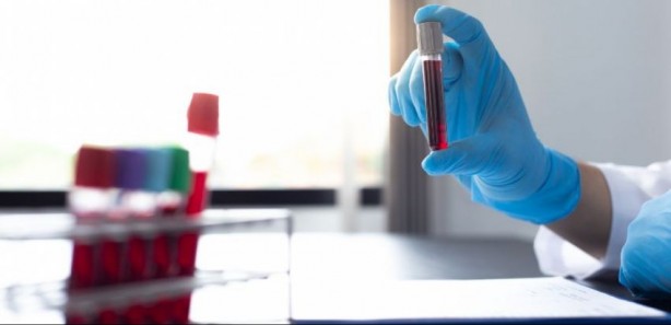 Foto - Araştırma sonuçları ortaya çıktı! İşte demans hastalığında en riskli kan grubu