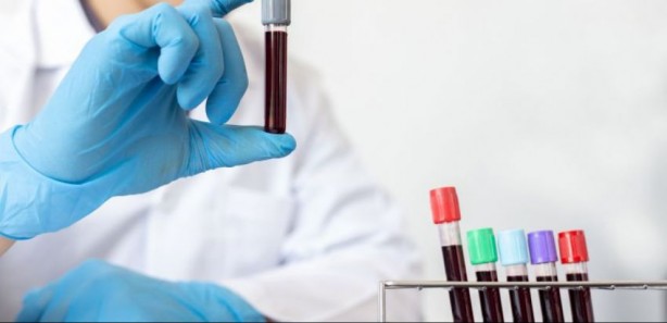 Foto - Araştırma sonuçları ortaya çıktı! İşte demans hastalığında en riskli kan grubu