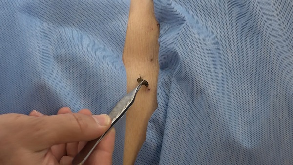 Foto - Arılarla şifa buluyorlar! Bu yöntem 5 bin yıldır kullanılıyor