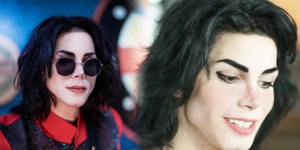 Foto - Arjantinli genç Michael Jackson'a benzemek istedi! Aradaki fark için defalarca operasyon geçirdi! Görenler şaştı kaldı