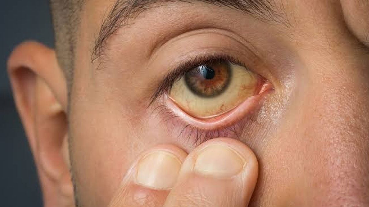Foto - Arkasında ciddi bir hastalık yatıyor olabilir! Gözlerdeki bu belirtiyi hafife almayın