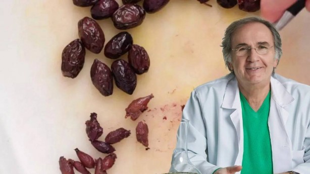 Foto - Asıl antibiyotik eczanede değil evimizdeymiş! İbrahim Saraçoğlu "Sakın atmayın" deyip gizli kür tarifini verdi! Boğaza sarınca bakın neler oluyor neler