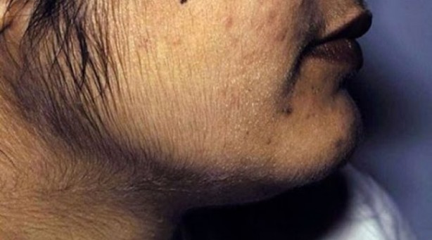 Foto - Aşırı terleyenler dikkat! Bunu kesinlikle yapmalısınız! Uzman isimden tavsiye