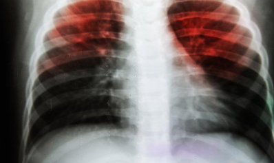 Foto - Aşırı terleyenler dikkat! Bunu kesinlikle yapmalısınız! Uzman isimden tavsiye