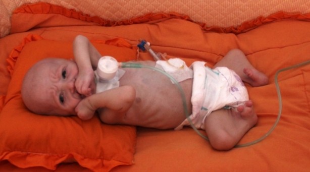 'Aslan Sendromu'yla doğdu