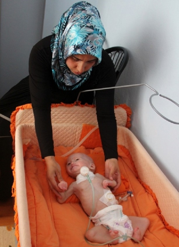 Foto - 'Aslan Sendromu'yla doğdu