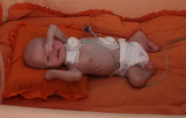 Foto - 'Aslan Sendromu'yla doğdu