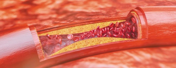 Foto - Aspirini sakın böyle kullanmayın! Ölüme bile yol açıyor