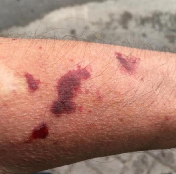 Foto - 'Asya Kaplan Sivrisineği' İstanbul’da görüldü! Tek bir ısırığı bile…