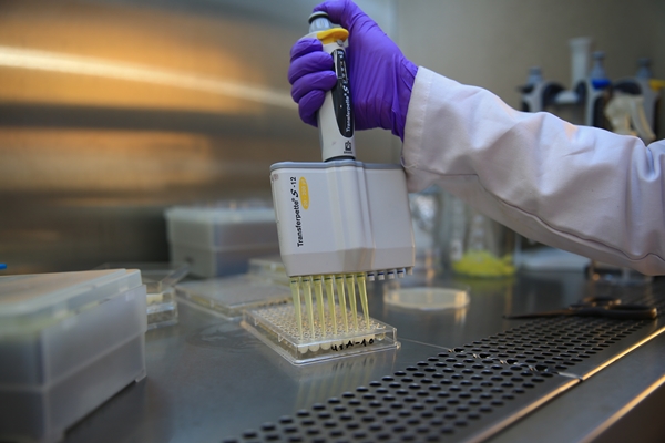 Foto - 'Atık yoğurt suyu' ile bunun yapılabileceğini biliyor muydunuz?