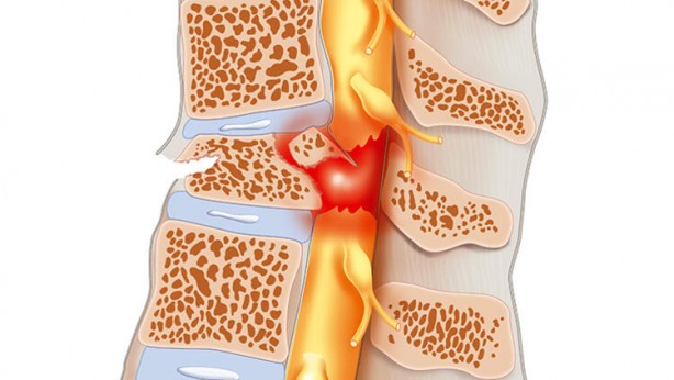Foto - Avrupa ülkesinde çığır açacak buluş! Milyonlarca insana umut verdi