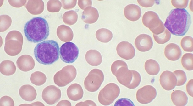 Avrupa ülkesinde çığır açacak buluş! Milyonlarca insana umut verdi