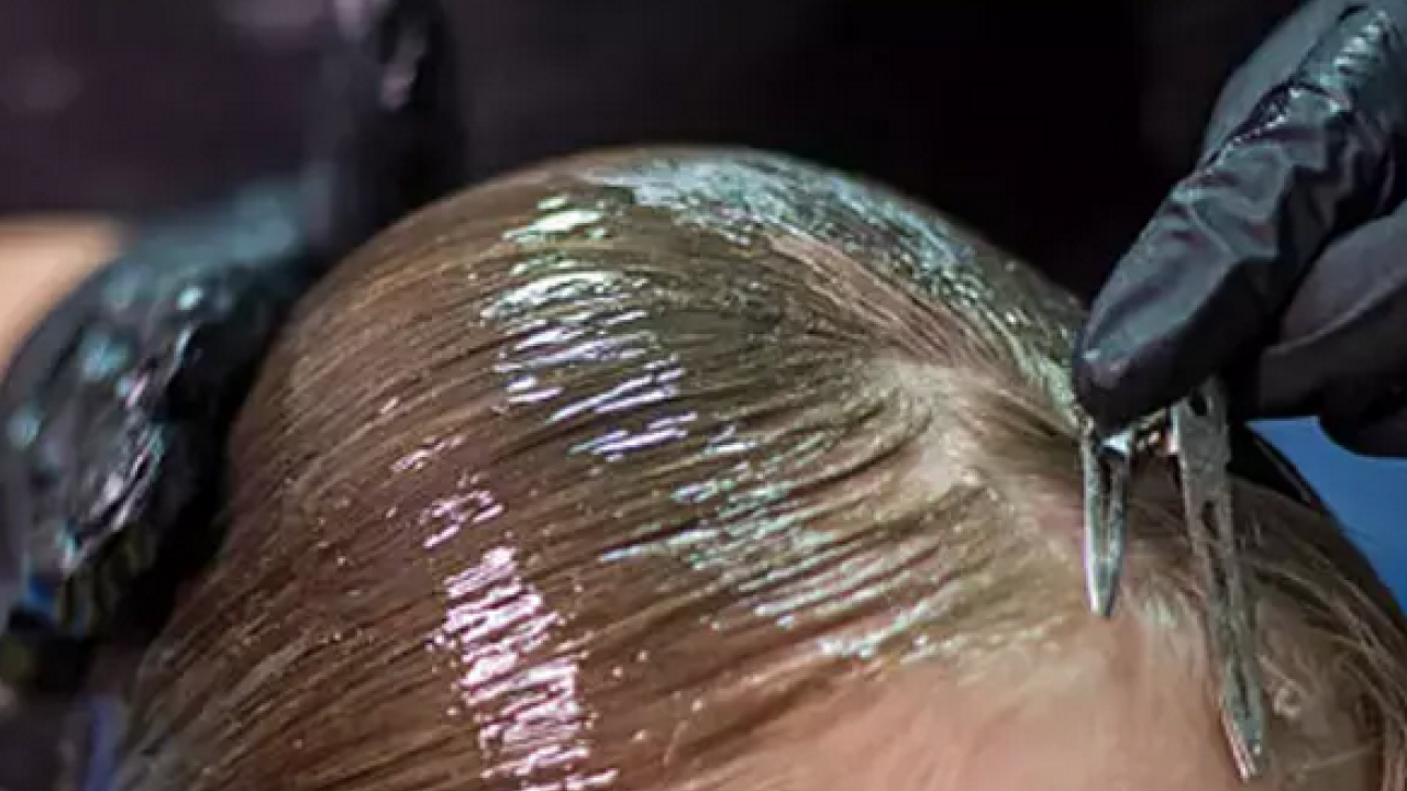 Foto - Avuç avuç saç dökülmesi: Saç döken toplama hatası! Tarayıp sıkan yandı, adeta kel bırakıyor