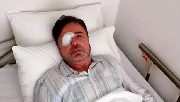 Foto - Avukat gözlükten kurtulmak isterken kör oldu!