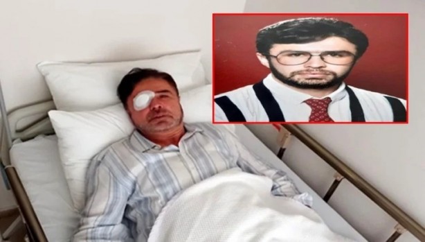 Foto - Avukat gözlükten kurtulmak isterken kör oldu!