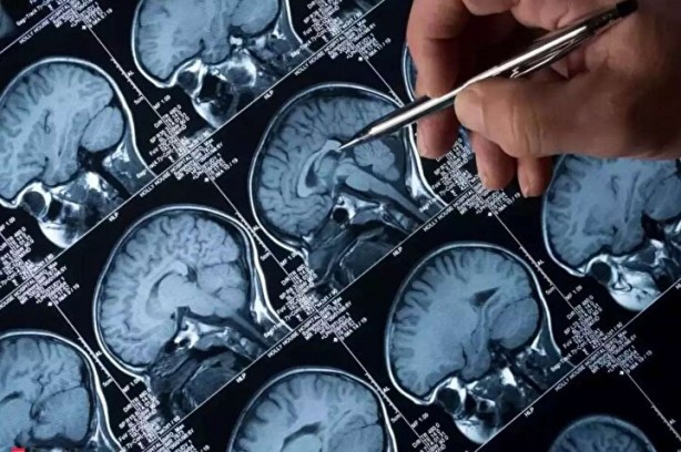 Foto - Avustralya'da yeni salgın ortaya çıktı