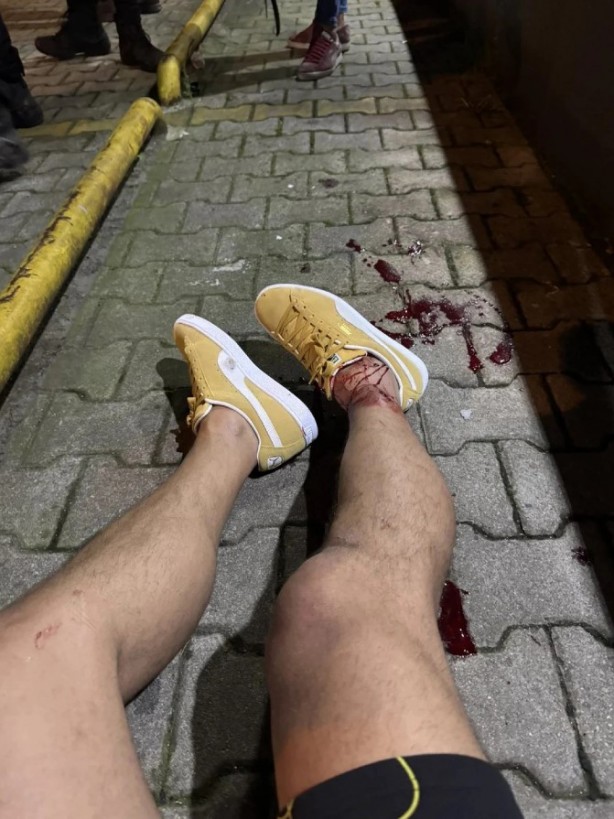 Foto - Ayağına sıkmışlardı: Serhat Akın'ın geçen haftaki itirafı gündemi salladı!