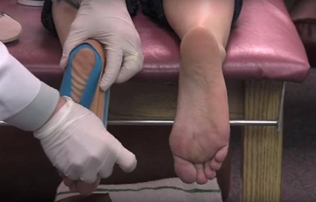 Foto - Ayağınızdaki ağrının sebebi topuk dikeni olabilir!