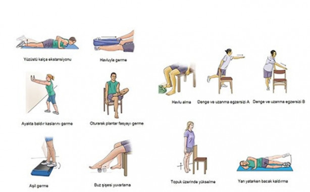 Foto - Ayağınızdaki ağrının sebebi topuk dikeni olabilir!